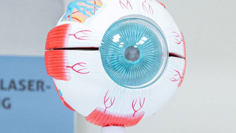 Modell Auge, Augenlasern Wien, Dr. Atamniy