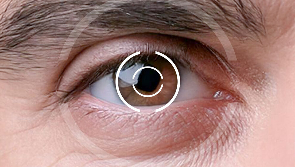 Das Bild zeigt eine Nahaufnahme des menschlichen Auges - Augenlasern Wien, Dr. Atamniy