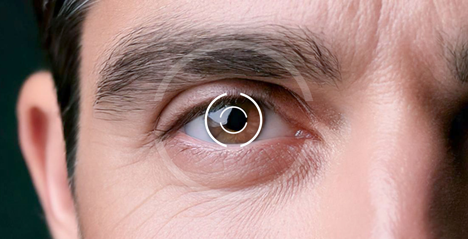 Das Bild zeigt eine Nahaufnahme des menschlichen Auges - Augenlasern Wien, Dr. Atamniy